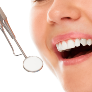 Dental Sealants in Yelahanka | Fluoride Treatment | Dental Sage