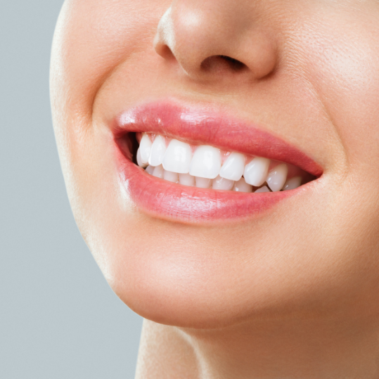 Teeth Whitening Yelahanka | Dr. Smita Pattanayak | Dental Sage