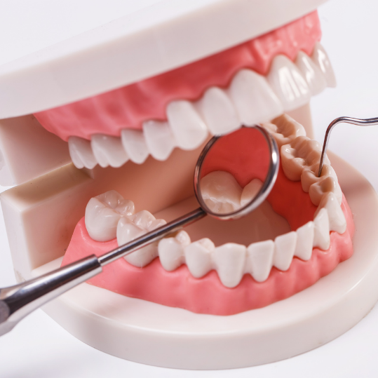 Partial dentures in Yelahanka, Bangalore | Dental Sage