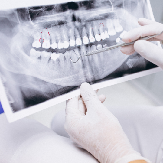 Digital Dental X ray in Yelahanka | Dental Sage