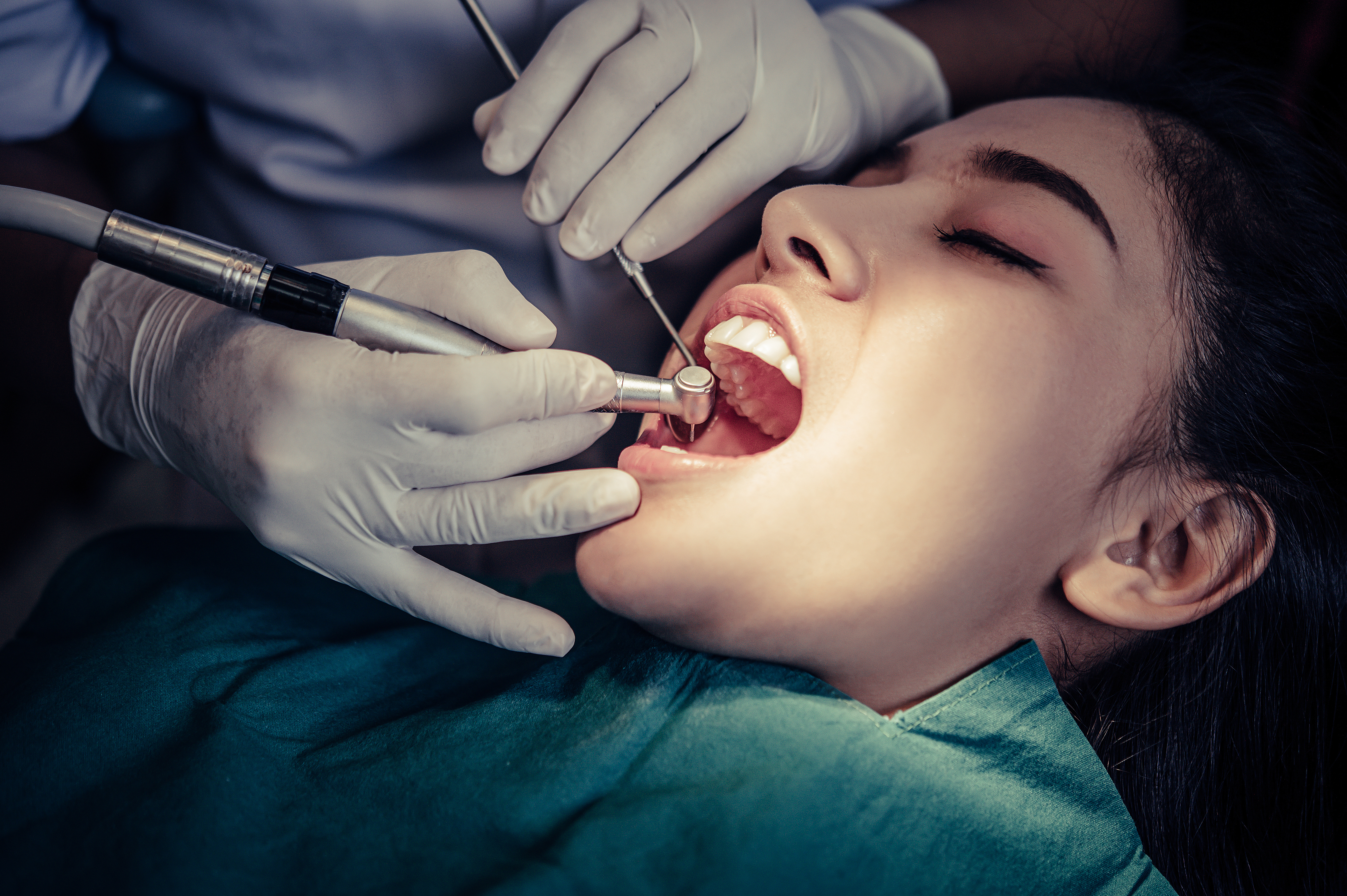 Best Dental Implants in Yelahanka | Dental Sage