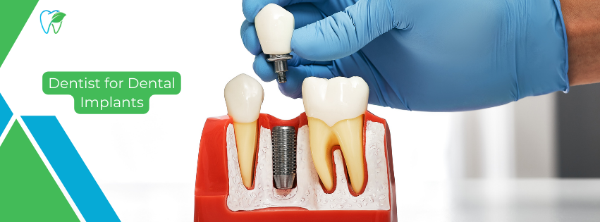 Dental Implants - Best Dentist in Yelahanka for Dental Implants - Dental Sage